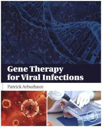 Gene Therapy for Viral Infections