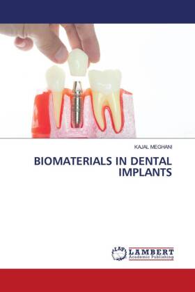 BIOMATERIALS IN DENTAL IMPLANTS