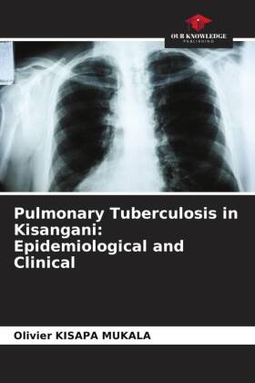 Pulmonary Tuberculosis in Kisangani: Epidemiological and Clinical