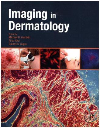 Imaging in Dermatology