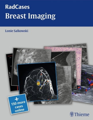 Radcases Breast Imaging