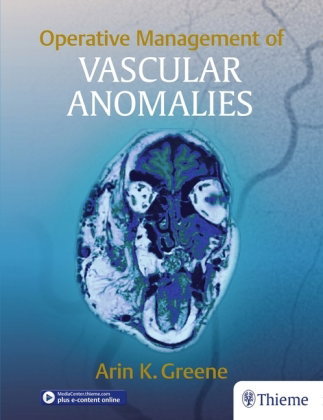 Operative Management of Vascular Anomalies