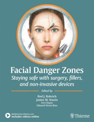 Facial Danger Zones