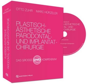 Plastisch-Ästhetische Parodontal- und Implantatchirurgie, 4 DVD-Video