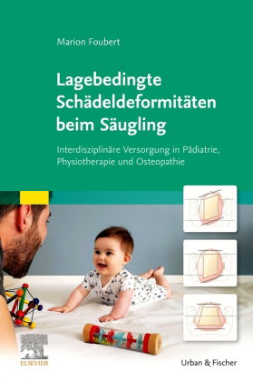 Lagebedingte Schädeldeformitäten beim Säugling