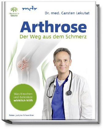Arthrose