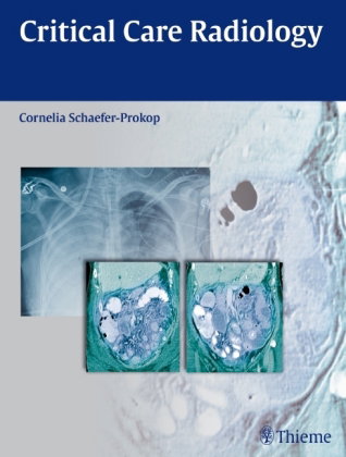 Critical Care Radiology