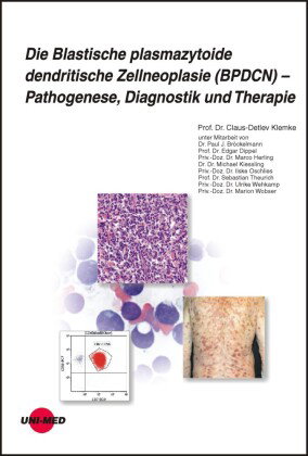 Die Blastische plasmazytoide dendritische Zellneoplasie (BPDCN) - Pathogenese, Diagnostik und Therap