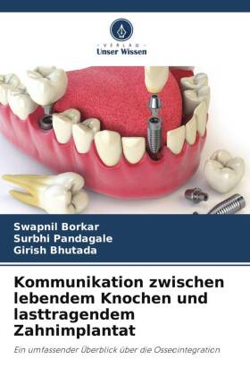 Kommunikation zwischen lebendem Knochen und lasttragendem Zahnimplantat