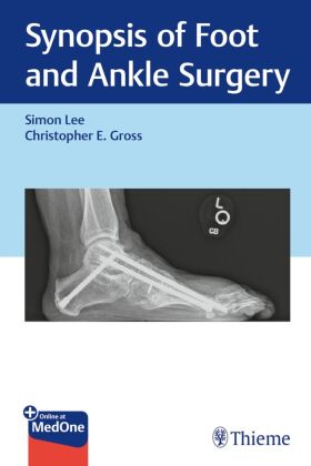 Synopsis of Foot and Ankle Surgery