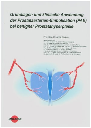 Grundlagen und klinische Anwendung der Prostataarterien-Embolisation (PAE) bei benigner Prostatahype