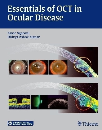 Essentials of OCT in Ocular Disease