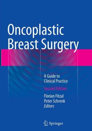 Oncoplastic Breast Surgery