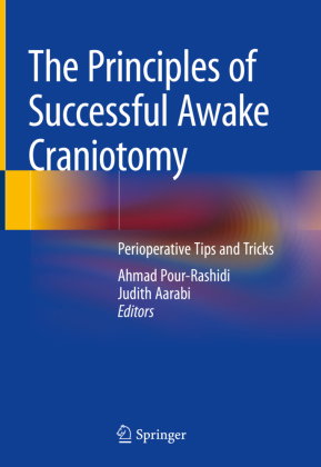 The Principles of Successful Awake Craniotomy