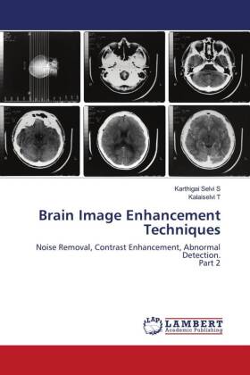 Brain Image Enhancement Techniques