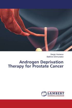 Androgen Deprivation Therapy for Prostate Cancer
