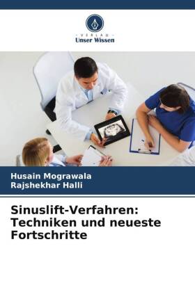 Sinuslift-Verfahren: Techniken und neueste Fortschritte