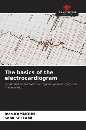 The basics of the electrocardiogram