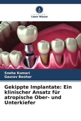 Gekippte Implantate: Ein klinischer Ansatz für atropische Ober- und Unterkiefer