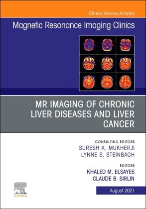 MR Imaging of Chronic Liver Diseases and Liver Cancer, An Issue of Magnetic Resonance Imaging Clinic