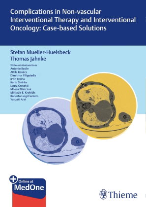 Complications in Non-vascular Interventional Therapy and Interventional Oncology: Case-based Solutio
